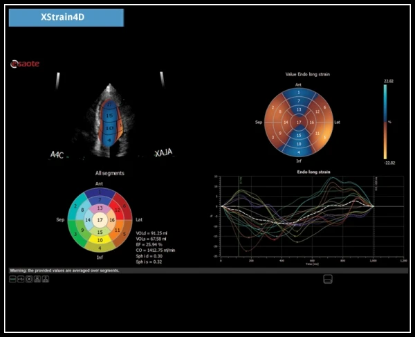 УЗИ аппарат Esaote MyLab X7