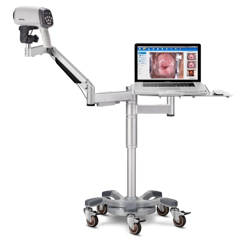 Кольпоскоп C6A HD