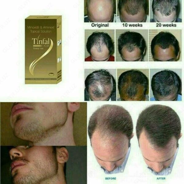 Tana yog'i toza tabiiy hindiston yong'og'i yog'i - 400 ml