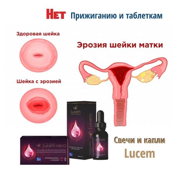 Suppozitorii Lucem vacci