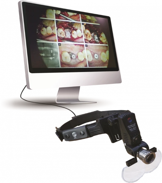 Nalobniy fonar KS-07