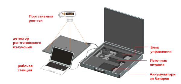 REX-525RU - Стационарный рентген-комплекс с детектором