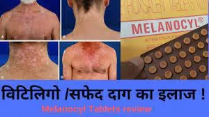 tabletkalari Melanosil (Melanocyl) ot vitiligo