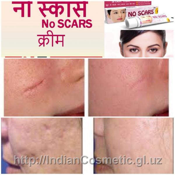 Krem protiv shramov NO-SCAR, 50 ml