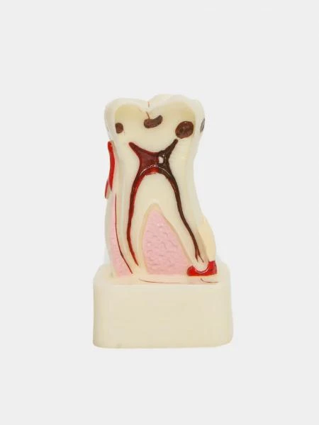 Муляж Pathology model