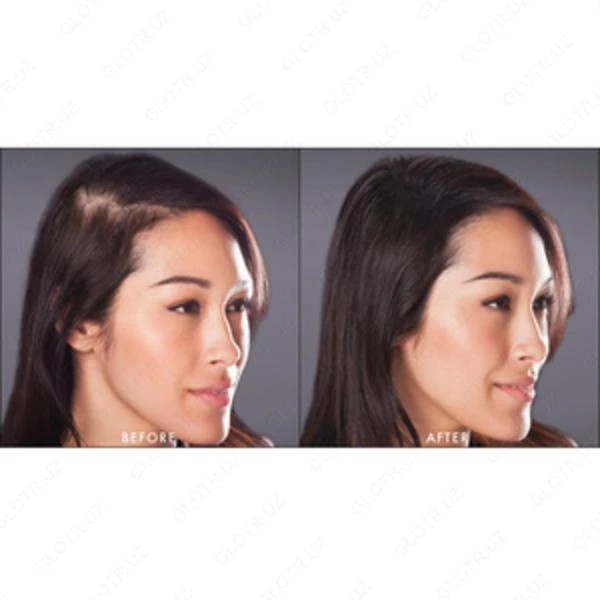 Laringoskop tipa Makintosh 4 klinka