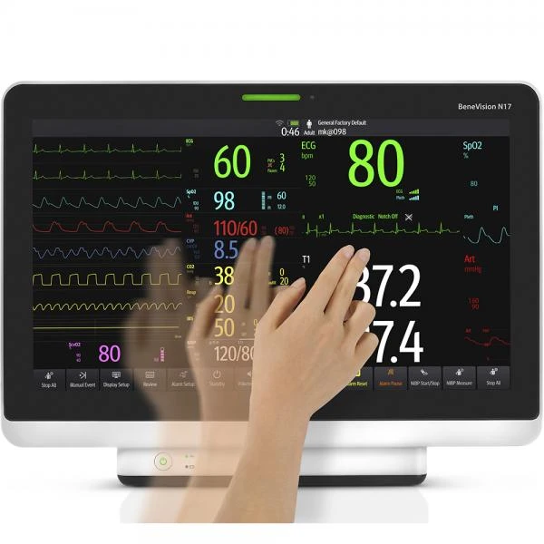 Мониторы пациента MINDRAY uMec N12 15 17