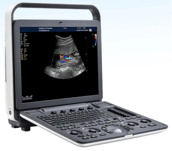 UZI portativnoe MediSono (SSHA) P11 PLUS