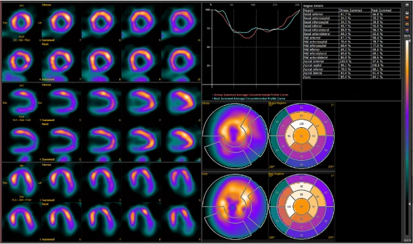AnyScan Trio SPECT/CT/PET tizimi