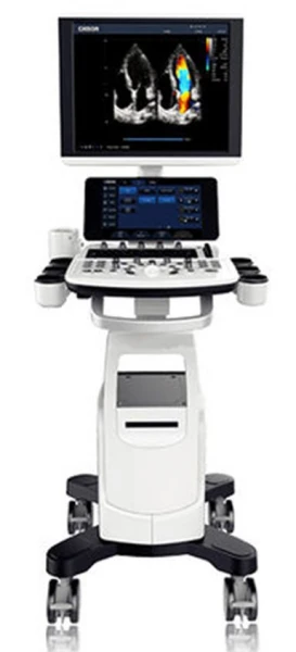 Ultrazvukovoy skaner Chison i6 (UZI)