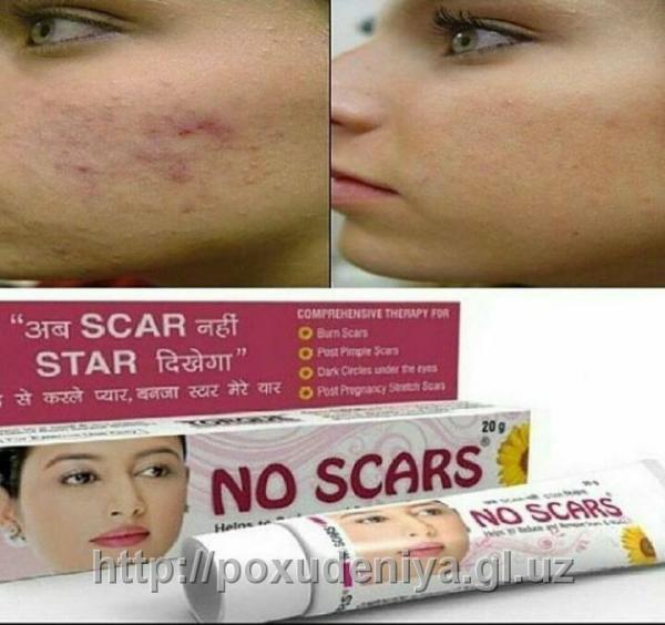 Крем против шрамов NO-SCAR