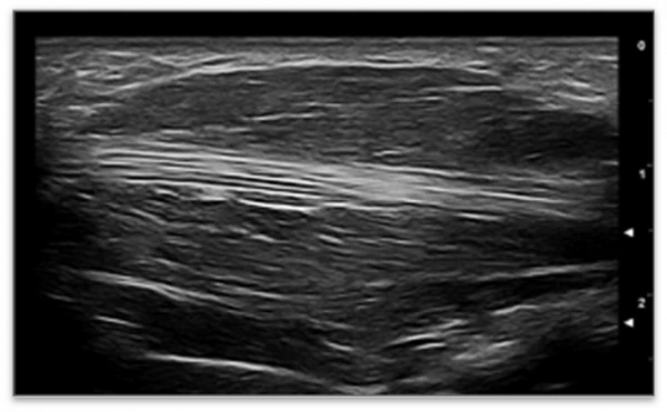 Esaote MyLab X5 ultratovush apparati