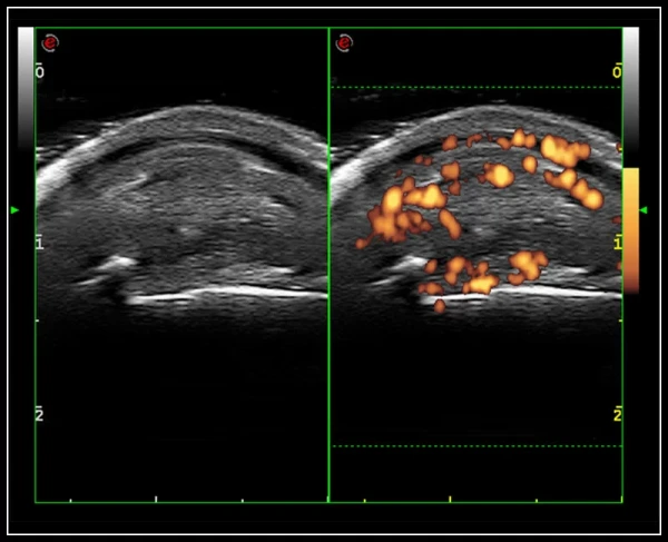 Ультразвуковой томограф нового поколения Esaote MyLab 9 eXp