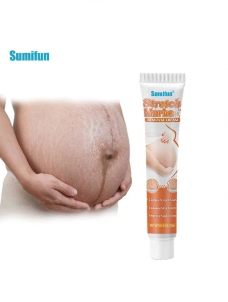Крем от растяжек и рубцов Sumifun Stretch Marks Cream 20 g