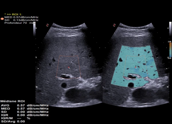 Ultrazvukovoy tomograf ESAOTE MyLab X90