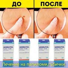 Веррутол (Verrutol) от папиллом