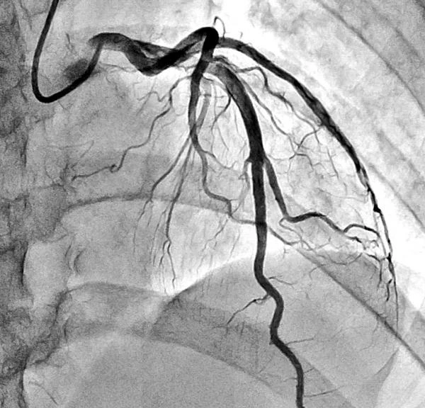 Ангиографическая система Shimadzu Trinias (Япония)