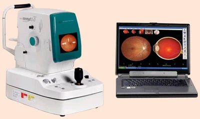 Nemidriaticheskaya sifrovaya fundus kamera nonmyd a-D firmi Kowa (Yaponiya)