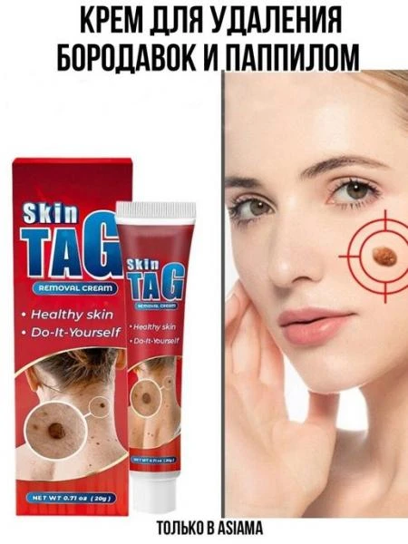 Крем для удаления бородавок и паппилом - 20 г Skin Tag