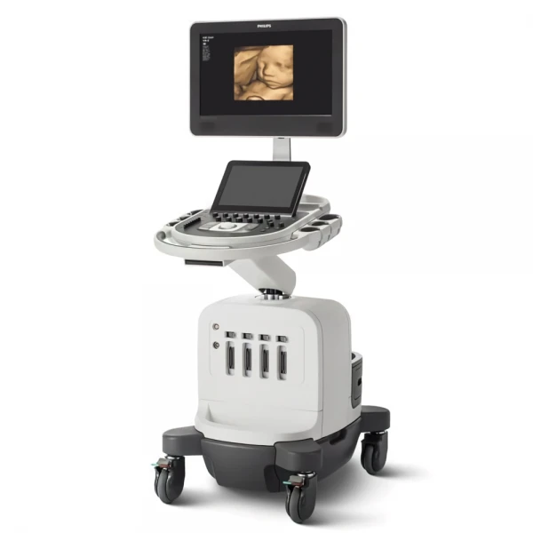 Ultrazvukovaya sistema Philips Affiniti 50