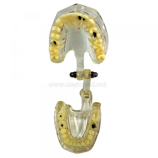 Муляж Adult pathology model