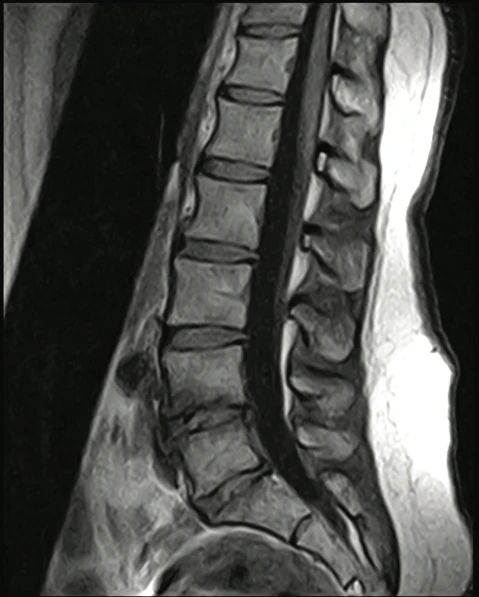 МРТ для исследования костно-мышечной системы Esaote S-Scan