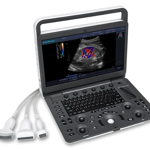Sistema ultrazvukovoy diagnostiki Model: SonoScape E3