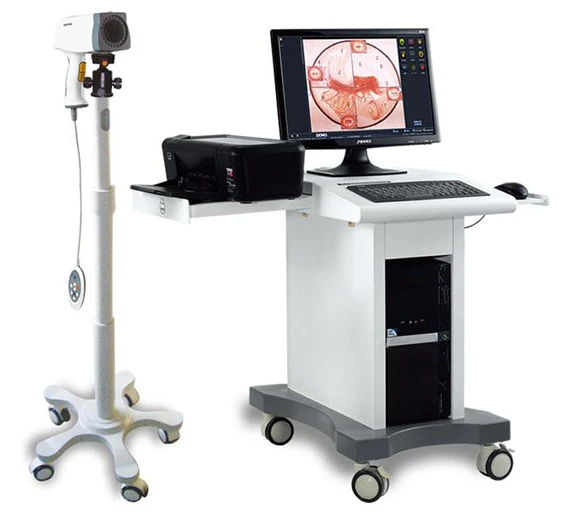 Цифровой видеокольпоскоп