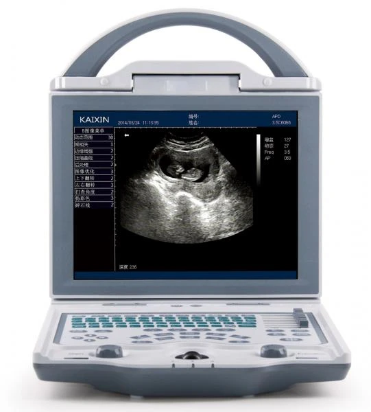 УЗИ Ультразвуковой сканер KX 2000F