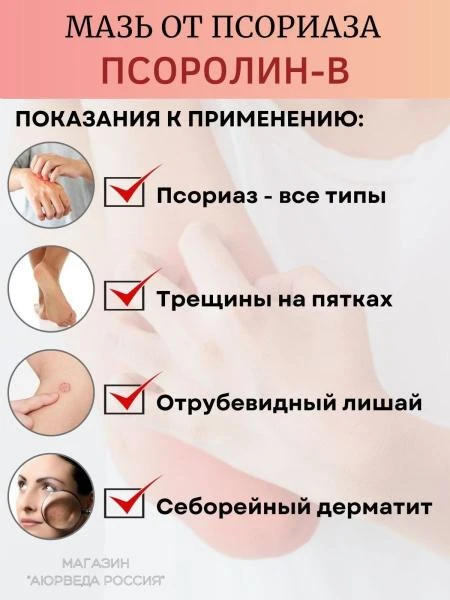 Psoriaz uchun terapevtik krem Рsorolin Оintment
