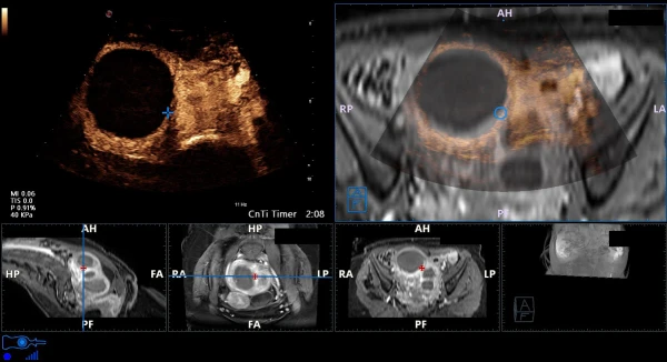 Ultrazvukovoy tomograf ESAOTE MyLab X90