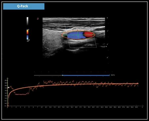ESAOTE MYLAB X7 ekspert toifali ultratovush apparati