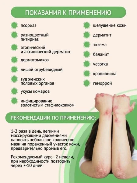 Psoriaz, dermatit, liken, qichishish uchun "baliqchining xazinasi" malhami