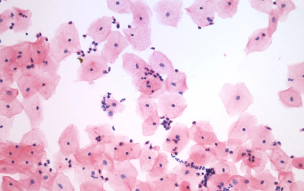 Mikroskop trinokulyarniy BS-2046T s sifrovoy kameroy