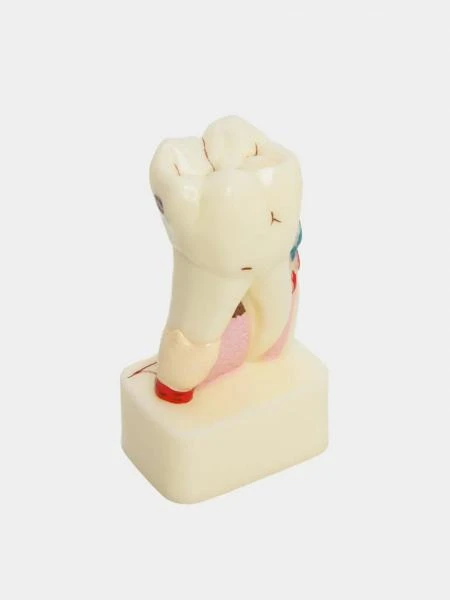 Муляж Pathology model