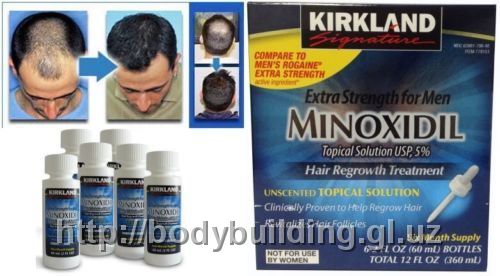 Kirkland Minoxidil
