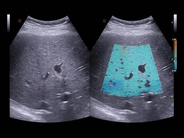 GE17-0230-01 SP-Сефадекс C-25,100 гтSP-SEPHADEX C-25, 100 G,