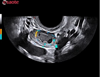 Esaote MyLab X75 universal ultratovush skaneri