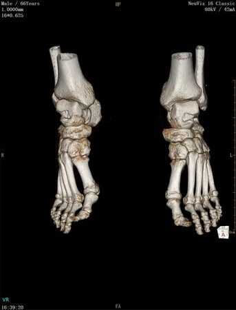 Компьютерная томография (КТ) NeuViz 16 Classic