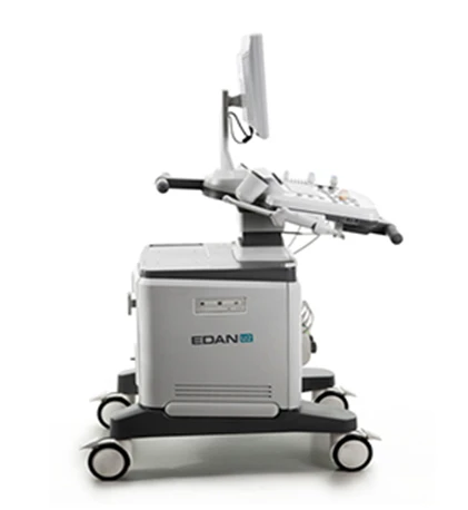 Ультразвуковой сканер U2 Edan