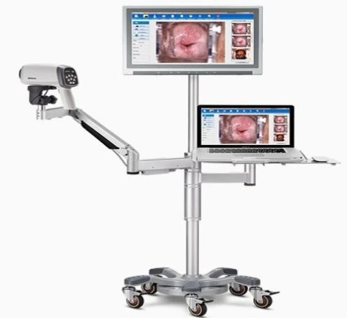 Videokolposkopi S6 HD