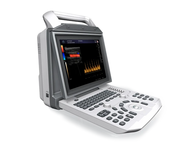 УЗИ-аппарат