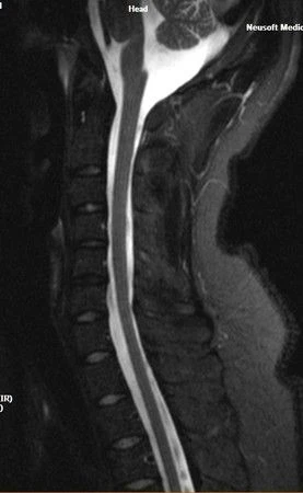 Магнитно-резонансная томография (МРТ) NSM-S15 1.5T