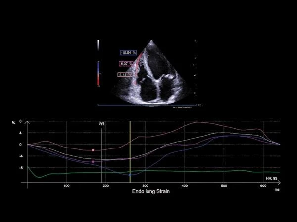 GE17-0230-01 SP-Сефадекс C-25,100 гтSP-SEPHADEX C-25, 100 G,