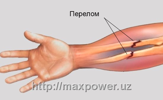 Шина для предплечья (левая, правая)