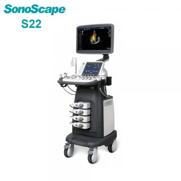 УЗИ SonoScape стационарные и портативные с Доплером