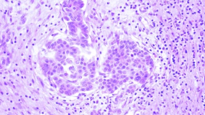 Mikroskop trinokulyarniy BS-2046T s sifrovoy kameroy