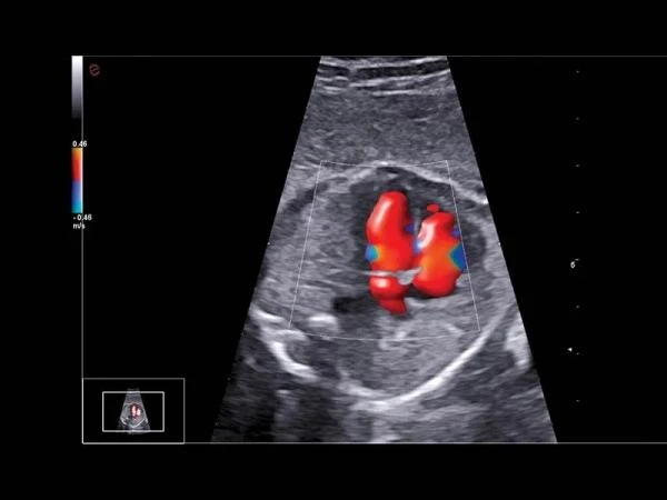 GE17-0230-01 SP-Сефадекс C-25,100 гтSP-SEPHADEX C-25, 100 G,