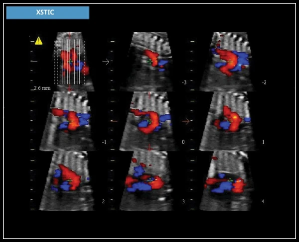 УЗИ аппарат Esaote MyLab X7