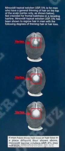 Миноксидил — лосьоны для волос и бороды